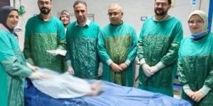 نجاح طبي بجامعة الزقازيق.. استخراج مسمار بطول 10 سم من طفلة دون جراحة