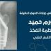 نجاح فريق العظام بمجمع الأقصر الطبى فى استئصال ورم حميد لسيدة فى الثلاثينات